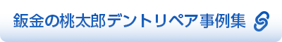 鈑金の桃太郎デントリペア事例集